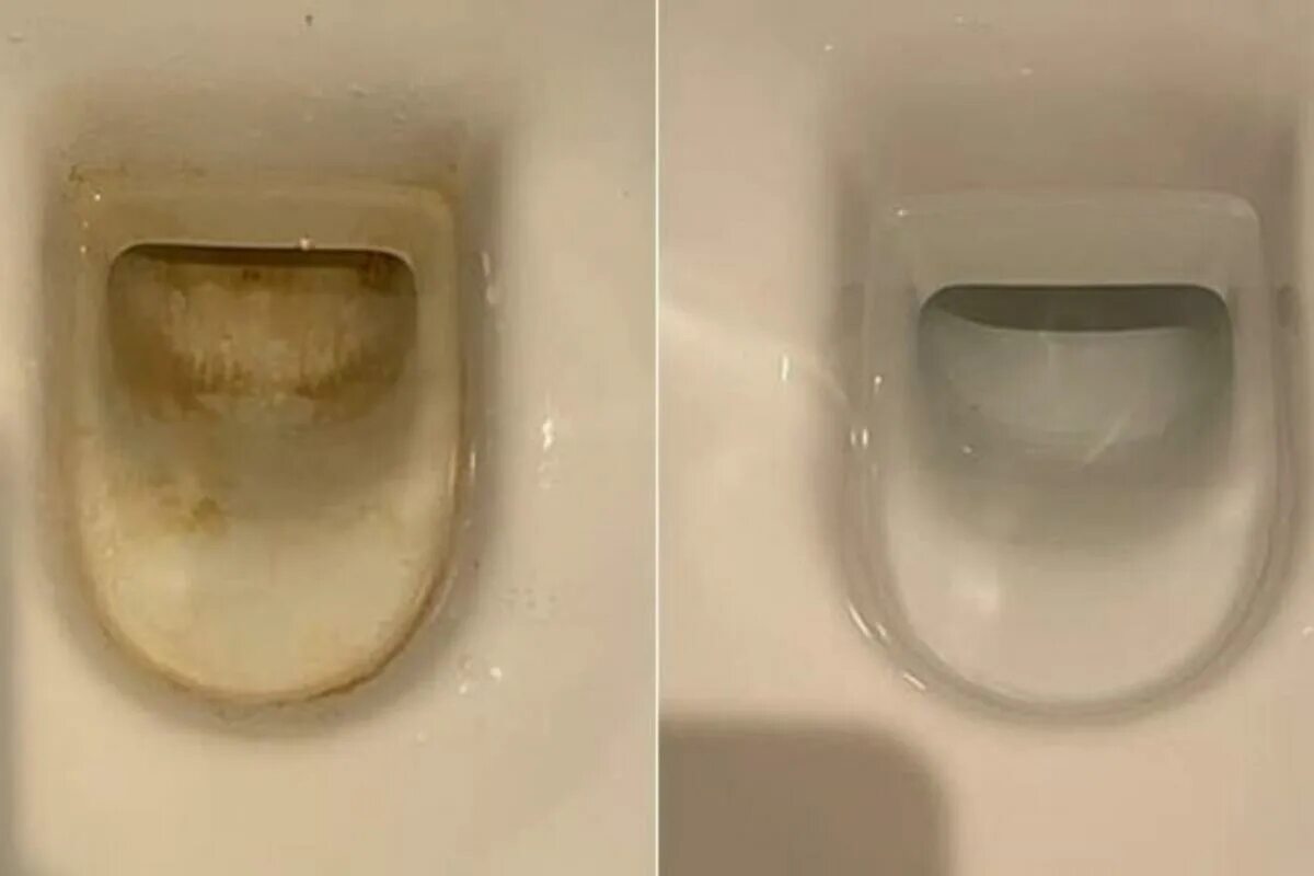 Wie kann man Kalkablagerungen aus der Toilettenschüssel entfernen und vor allem verhindern, dass sie wieder auftreten?